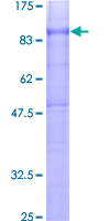 12.5% SDS-PAGE Stained with Coomassie Blue.